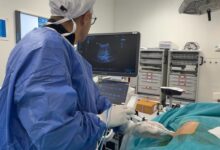 The Mohammed VI University Hospital of Agadir Successfully Performs Its First Radiofrequency Treatment for Liver Cancer 8 WhatsApp Image 2026 06 13 at 12.06.59